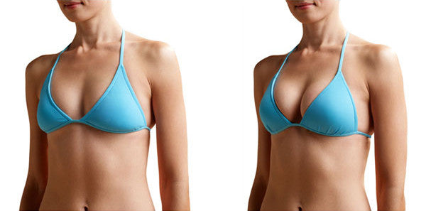 Magic Bodyfashion push-up silikon do plavek - Swim push-up Before - After